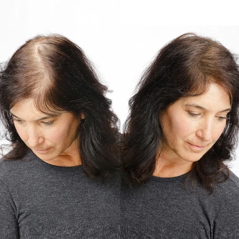 Toppik Hårfibrer Regular 12 g Mörkbrun Toppik