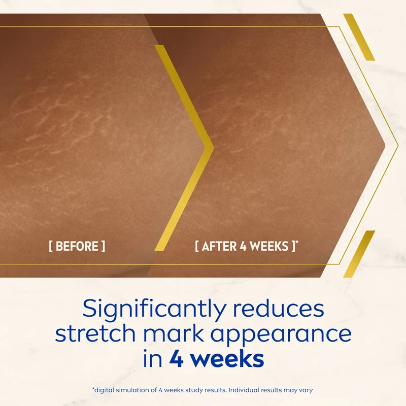 Nivea Luminous630 Body Oil-Serum Anti Stretch Marks 200ml Nivea