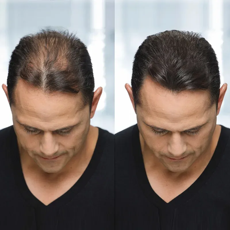 Toppik Hårfibrer Regular 12 g Mörkbrun Toppik