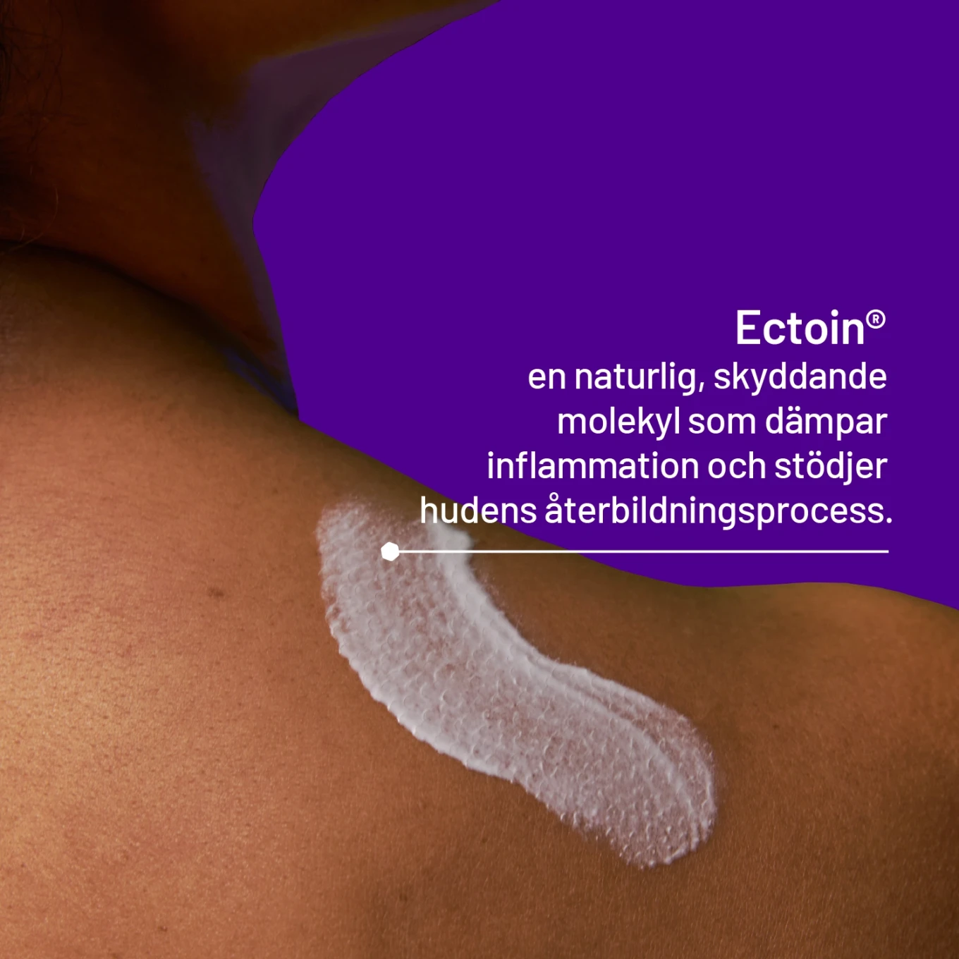 Locobase Psoriasis Cream 50 ml Locobase