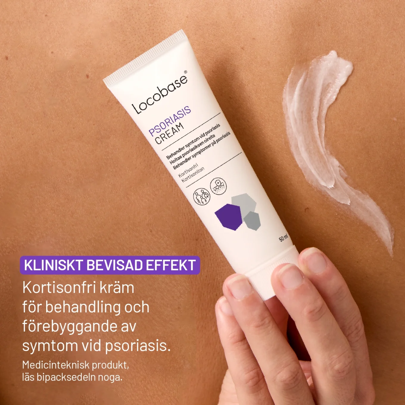 Locobase Psoriasis Cream 50 ml Locobase