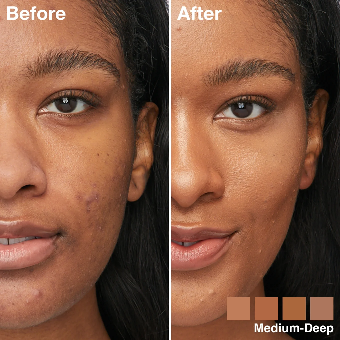 Maybelline New York Instant Perfector 4-in-1 Glow Makeup Foundation 20 ml 03 Medium Deep Maybelline New York