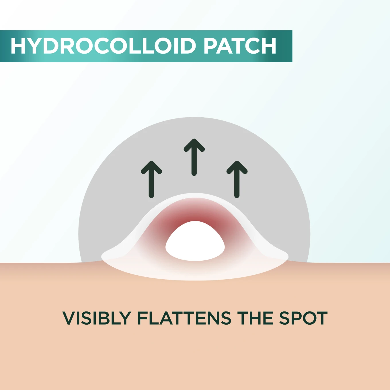 Garnier PureActive Pimple Patch For Impure Skin 22 st Garnier