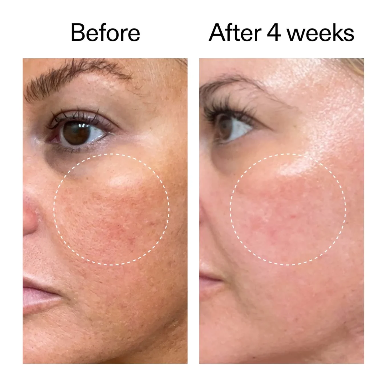 The Inkey List Starter Retinol Serum 30 ml The Inkey List 