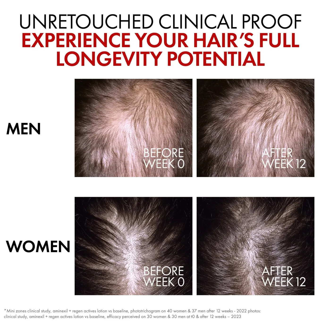 Vichy Dercos Aminexil R.E.G.E.N. Booster 90 ml Vichy