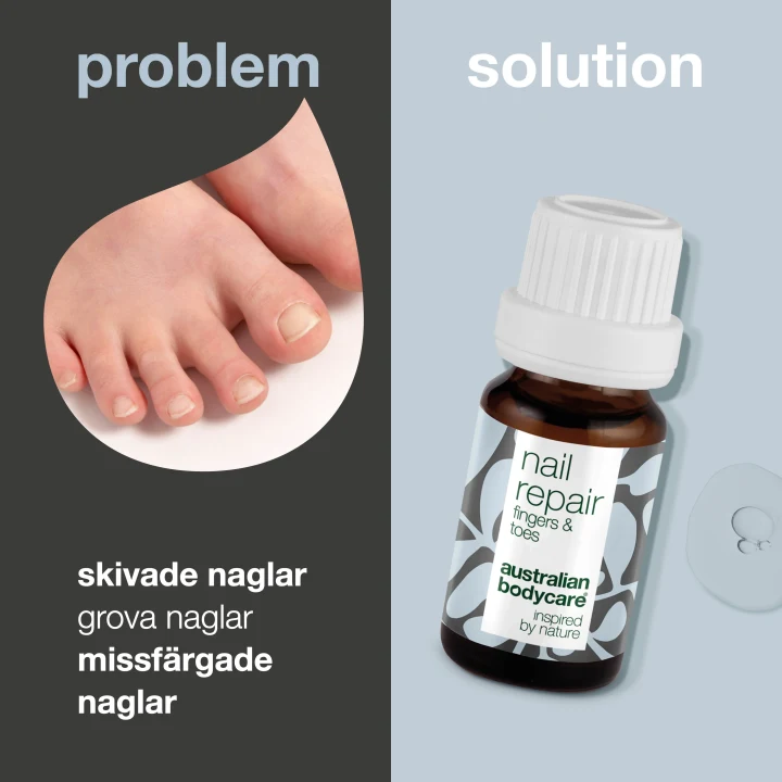 Australian Bodycare Nail Repair 10 ml Australian Bodycare
