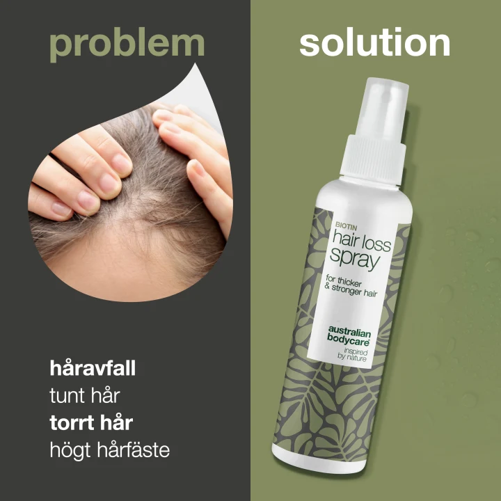 Australian Bodycare Hair Loss Spray 150 ml Australian Bodycare