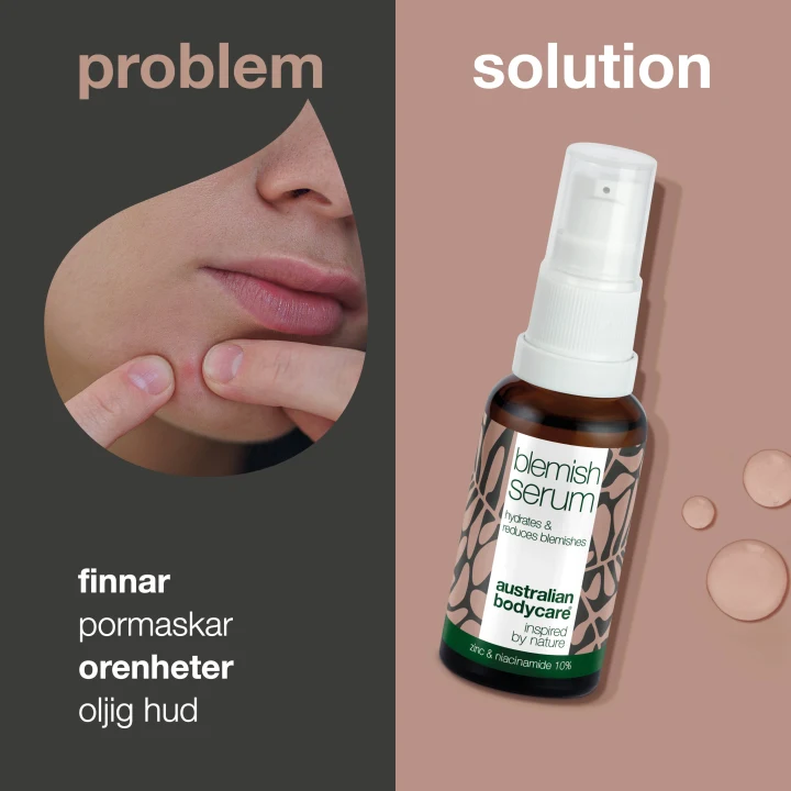 Australian Bodycare Blemish Serum 30 ml Australian Bodycare
