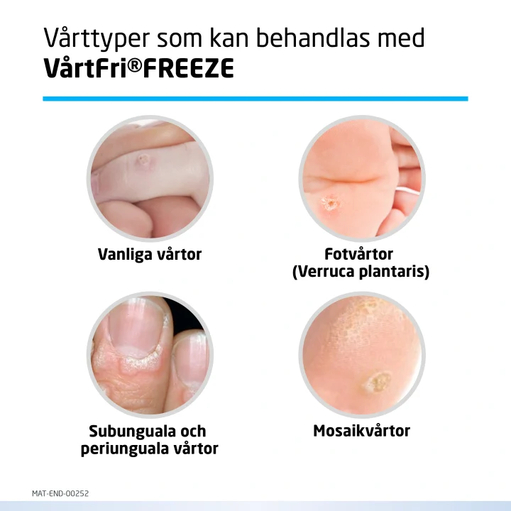 VårtFri FREEZE 14,3 g Vårtfri
